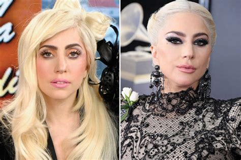 Lady Gaga Plastic Surgery